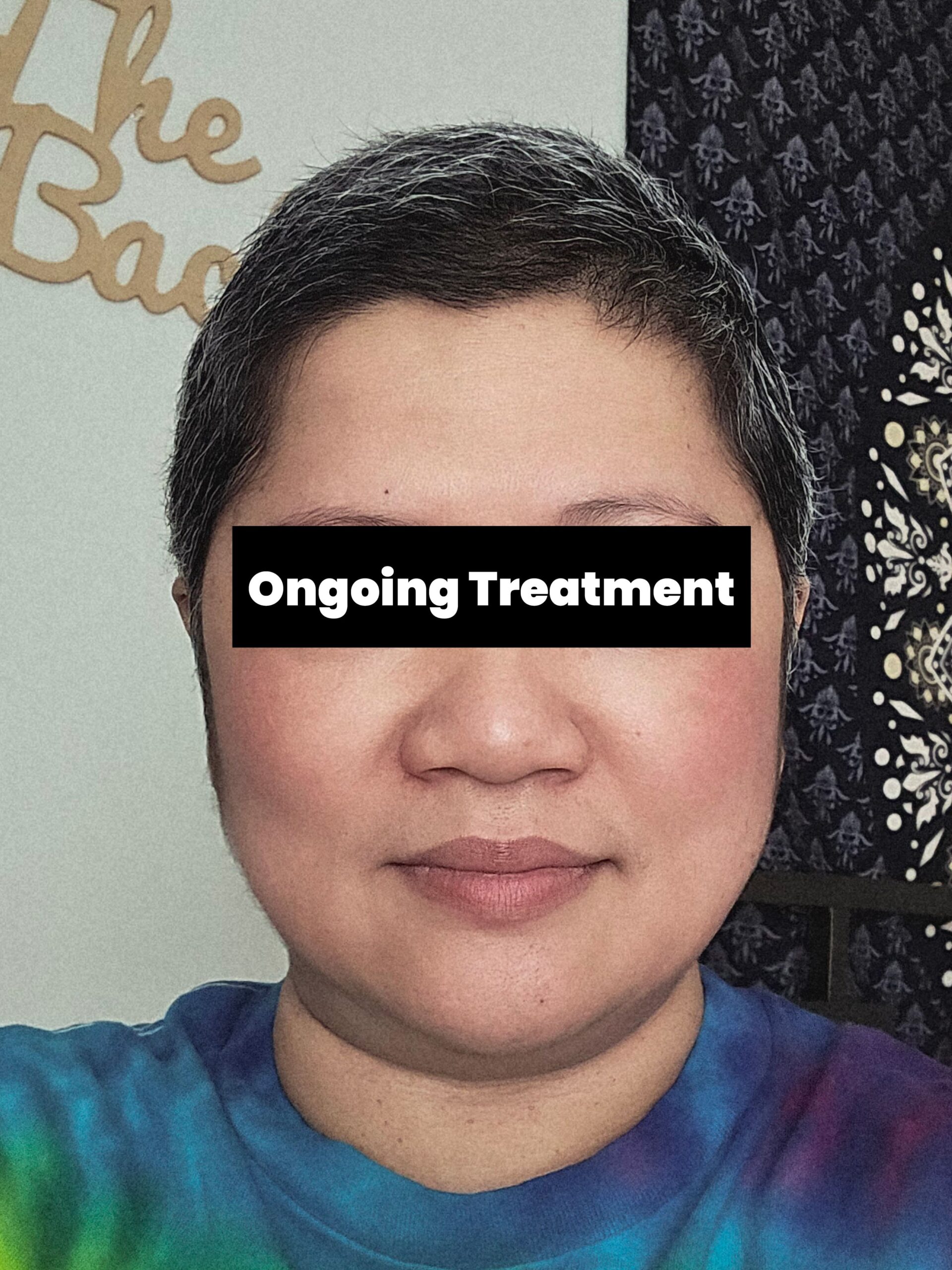 With Ongoing Treatment